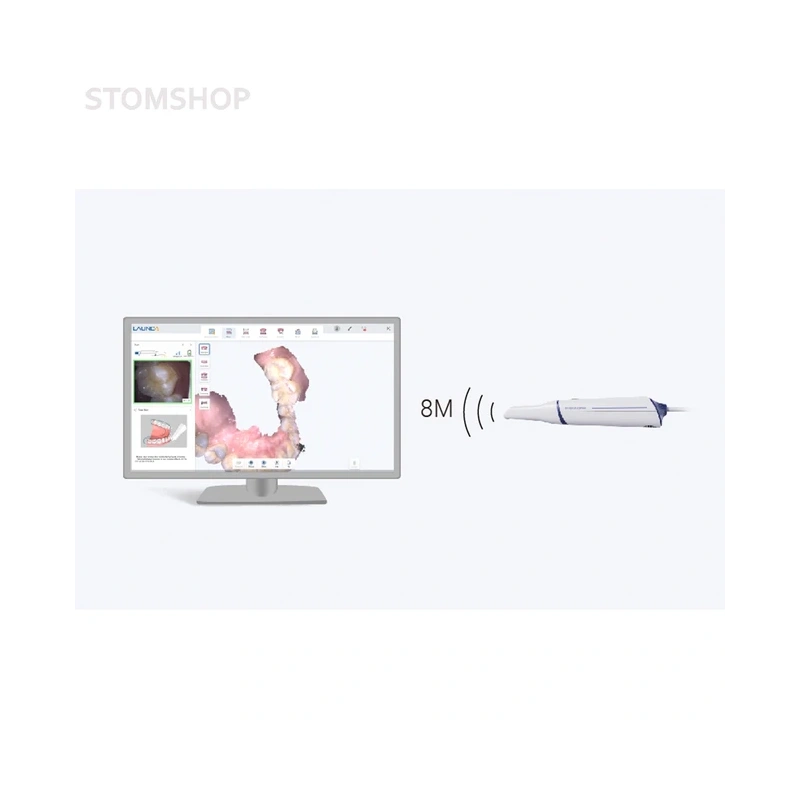 Launca DL-300 Wireless - беспроводной интраоральный сканер | Launca (Китай)