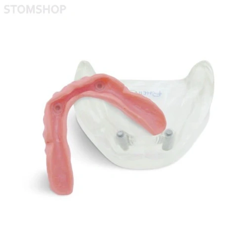 T11 – демонстрационная модель нижней челюсти с имплантами | GF Dental (Италия)