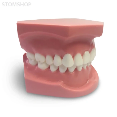 ORB01 – ортодонтическая модель с брекетами и твердой десной, 1 класс | GF Dental (Италия)