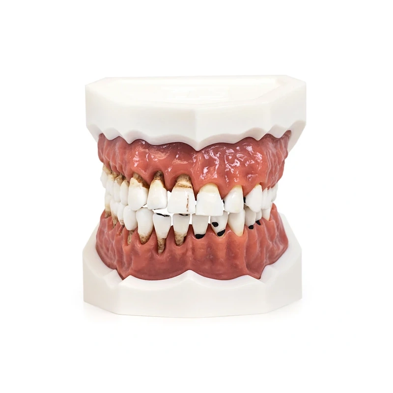 Модель верхней и нижней челюсти с различными патологиями | Dentalstore (Италия)