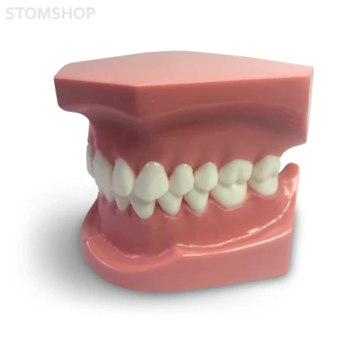 ORB01 – ортодонтическая модель с брекетами и твердой десной, 1 класс | GF Dental (Италия)