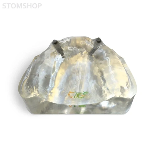 T12 – демонстрационная модель верхней челюсти с имплантами | GF Dental (Италия)