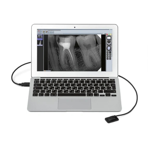 Mercury DIGISENS - цифровой радиовизиограф | New Life Radiology s.r.l. (Италия)