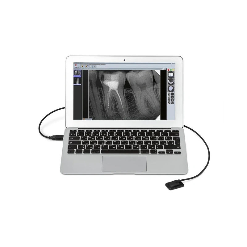 Mercury DIGISENS - цифровой радиовизиограф | New Life Radiology s.r.l. (Италия)