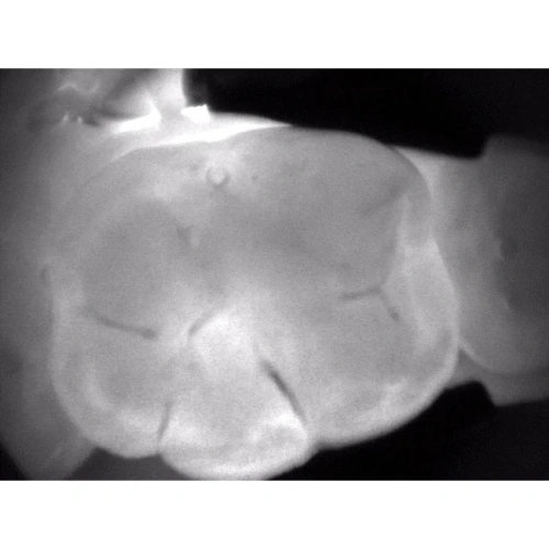 KaVo DIAGNOcam 2170 - прибор для диагностики кариозных поражений | KaVo (Германия)