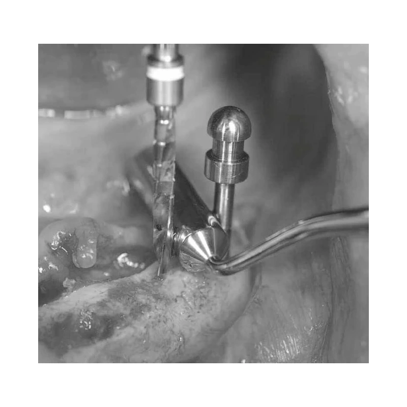 LM Implant Misura MR Kit - набор имплантологический | LM-Instruments Oy (Финляндия)