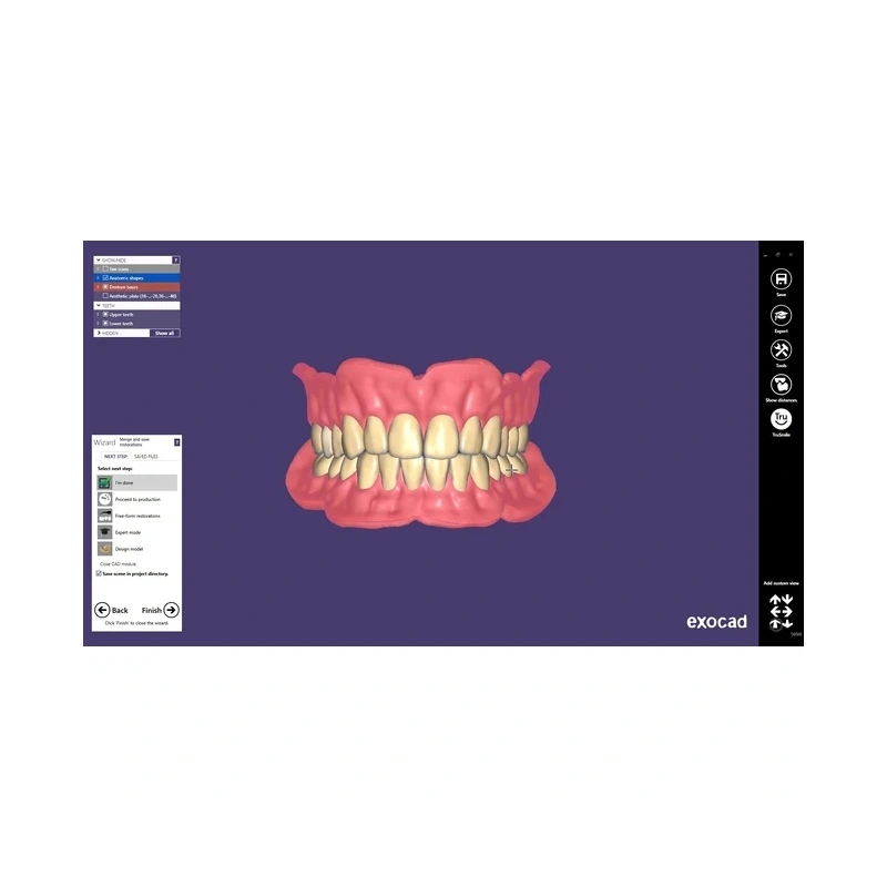 Exocad Full Denture Module - модуль для создания полносъемных протезов | Exocad (Германия)