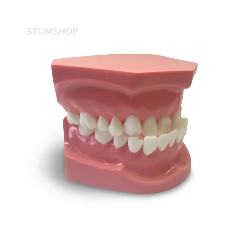 ORB04 – ортодонтическая модель с брекетами и твердой десной | GF Dental (Италия)