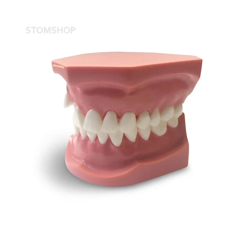 ORB05 – ортодонтическая модель с брекетами и твердой десной, 3 класс | GF Dental (Италия)