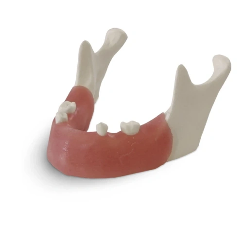 E82 – модель нижней челюсти для практики установки имплантатов | GF Dental (Италия)