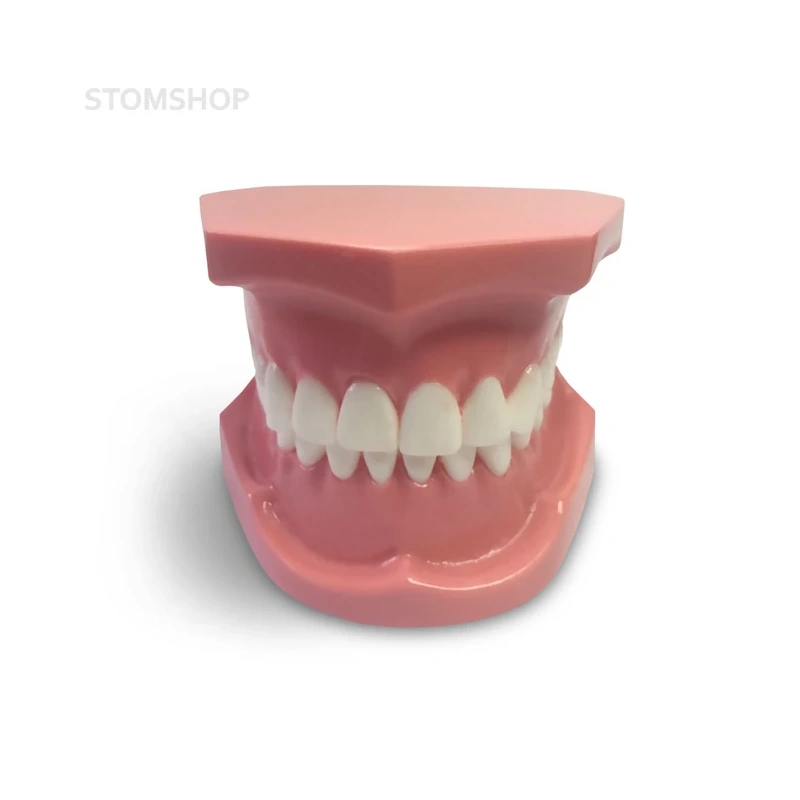 ORB01 – ортодонтическая модель с брекетами и твердой десной, 1 класс | GF Dental (Италия)