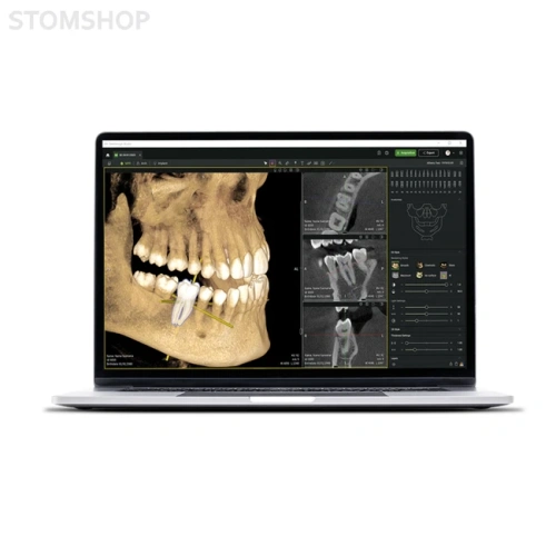 Seethrough Max - дентальный томограф | W&H DentalWerk (Австрия)