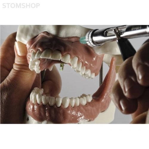 Модель челюсти для практики проведения местной анестезии | Dentalstore (Италия)