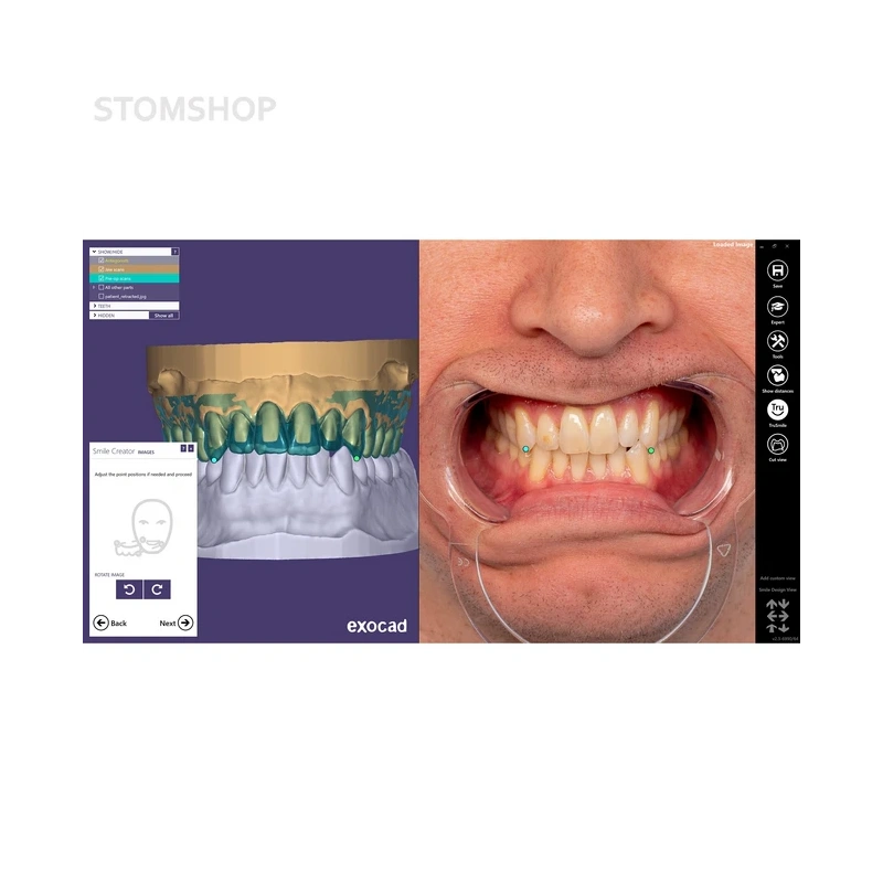 Exocad Smile Creator - модуль для планирования улыбки | Exocad (Германия)