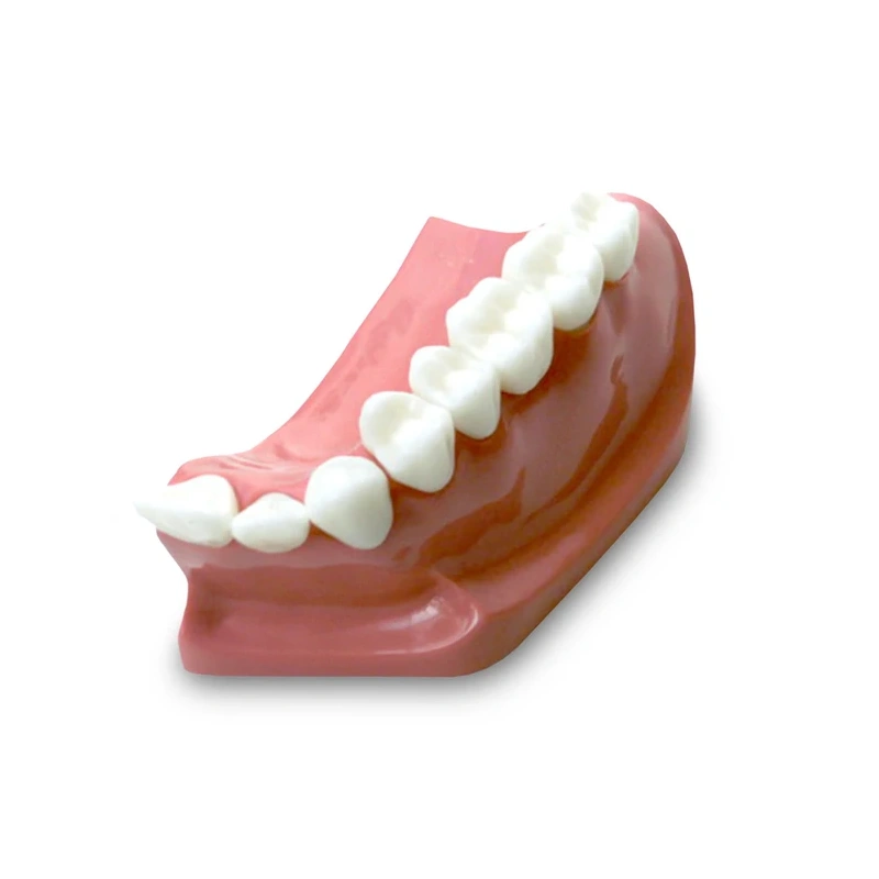 DM23 – модель верхней челюсти для демонстрации установки зубного моста | GF Dental (Италия)