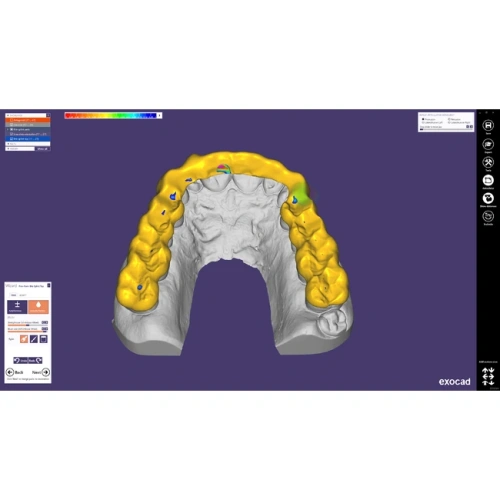 Exocad Bite Splint Module - модуль для создания терапевтических капп | Exocad (Германия)
