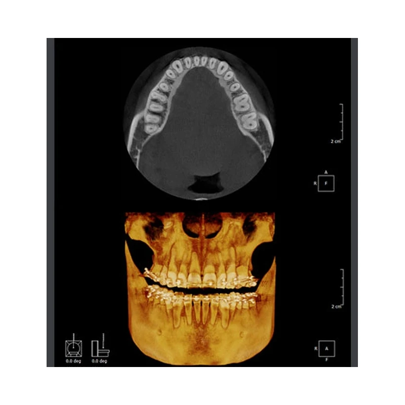 RAYSCAN Symphony Alpha 3D - ортопантомограф с компьютерным томографом, 3D 9х9 см | Ray Co., Ltd. (Ю. Корея)