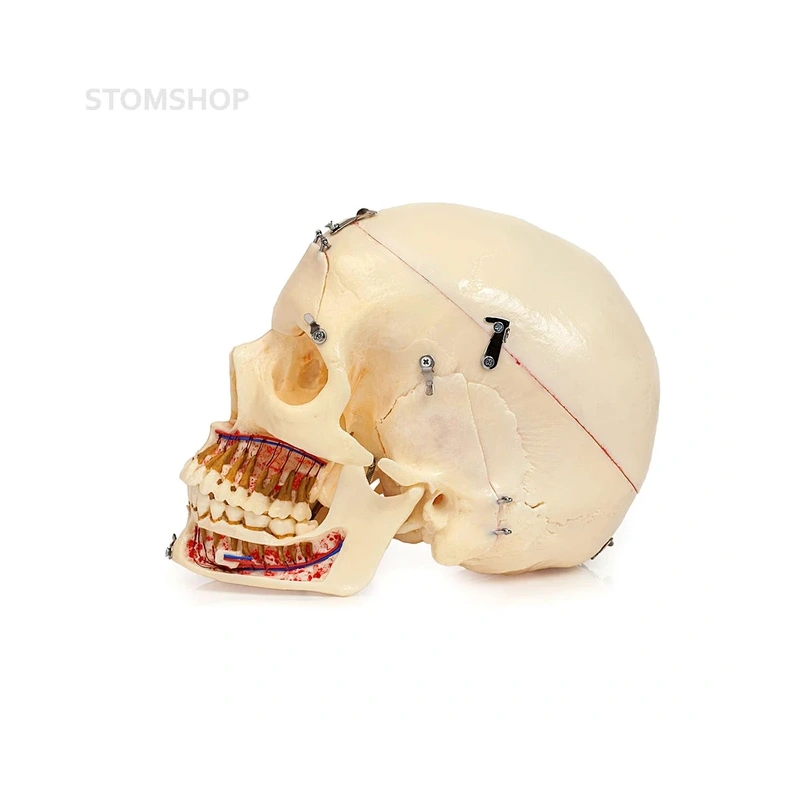 Демонстрационная модель черепа, состоящая из 10 частей | Dentalstore (Италия)