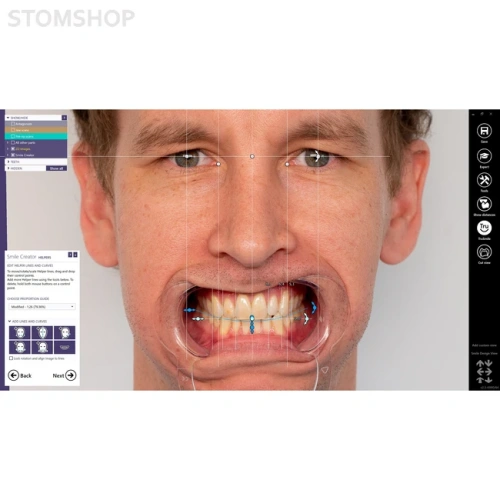 Exocad Smile Creator - модуль для планирования улыбки | Exocad (Германия)