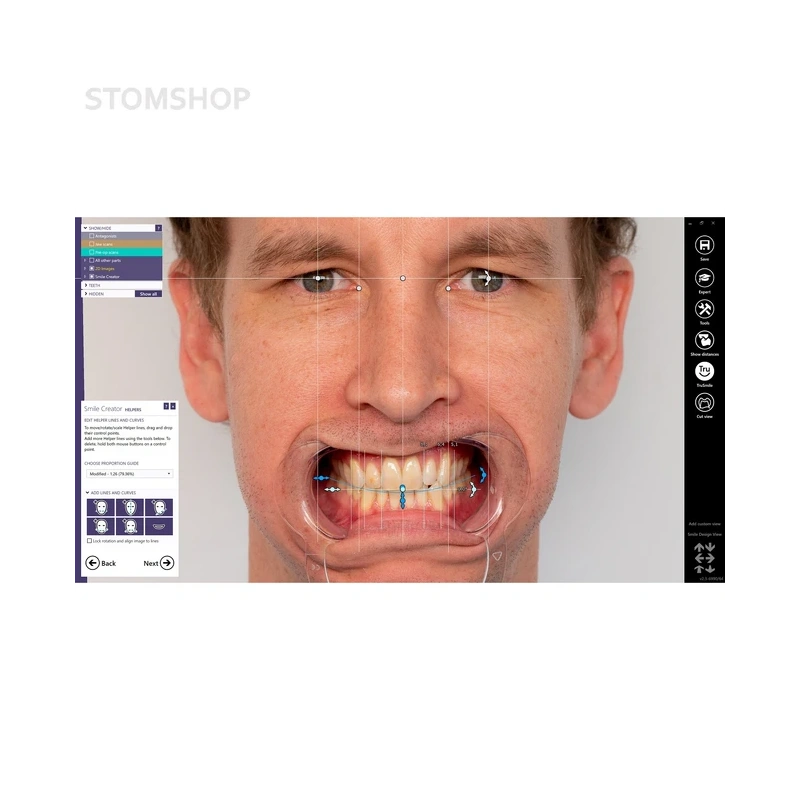 Exocad Smile Creator - модуль для планирования улыбки | Exocad (Германия)