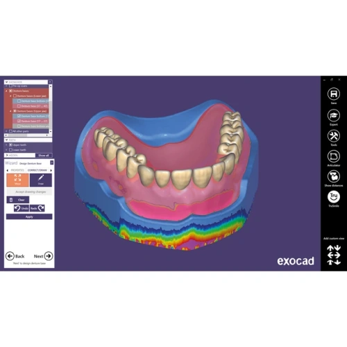 Exocad Full Denture Module - модуль для создания полносъемных протезов | Exocad (Германия)