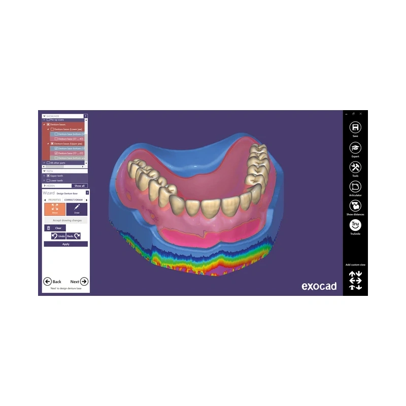 Exocad Full Denture Module - модуль для создания полносъемных протезов | Exocad (Германия)