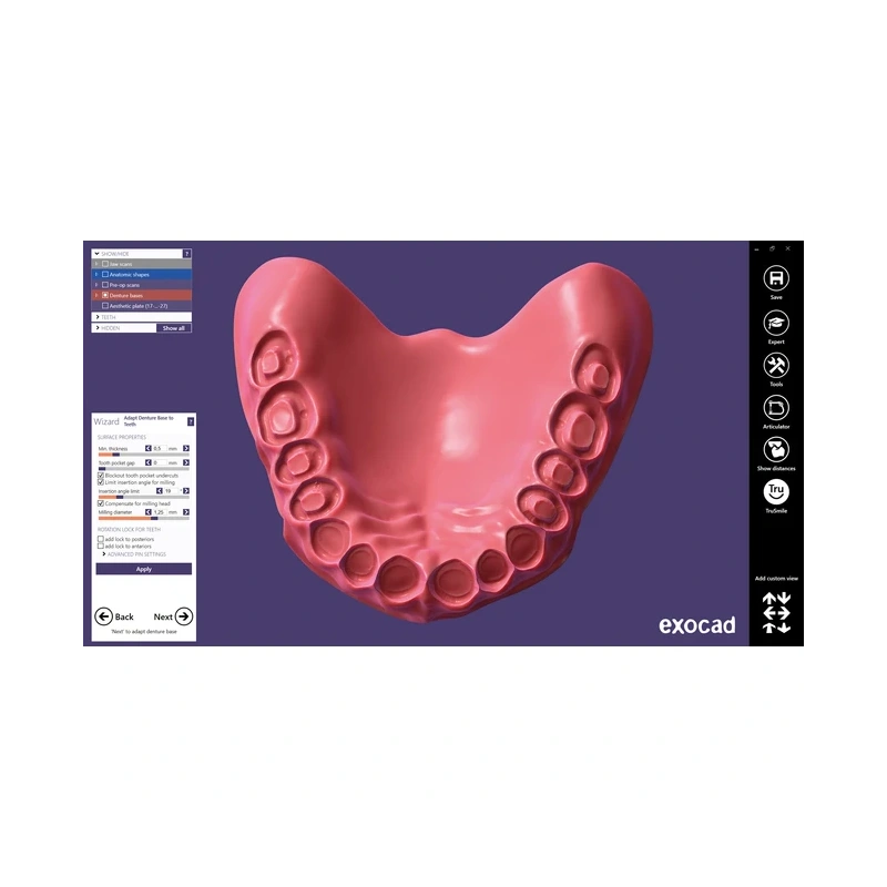 Exocad Full Denture Module - модуль для создания полносъемных протезов | Exocad (Германия)