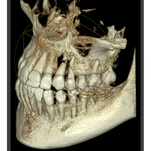 RAYSCAN Symphony Alpha 3D - ортопантомограф с компьютерным томографом, 3D 9х9 см | Ray Co., Ltd. (Ю. Корея)